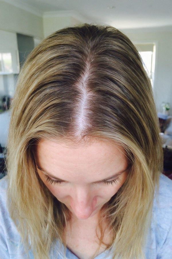 After photo, Chloe W · 29 · Hobart TAS