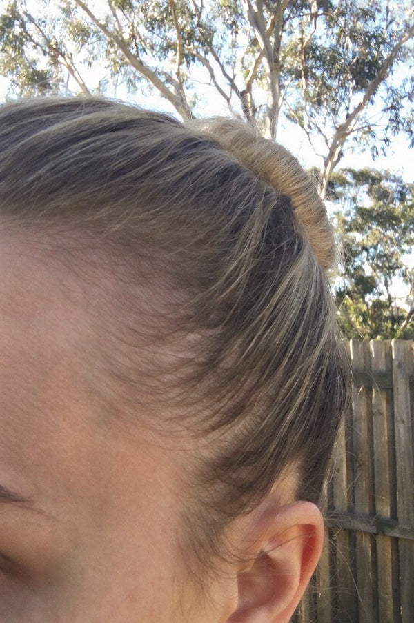 After photo, Lauren J · 41 · Wahroonga NSW