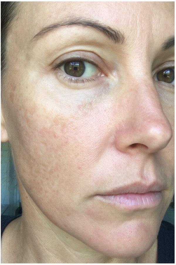 After photo, Nadia H · 45 · Castle Hill NSW